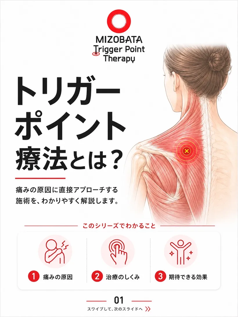 トリガーポイント療法とは？ — シリーズ導入