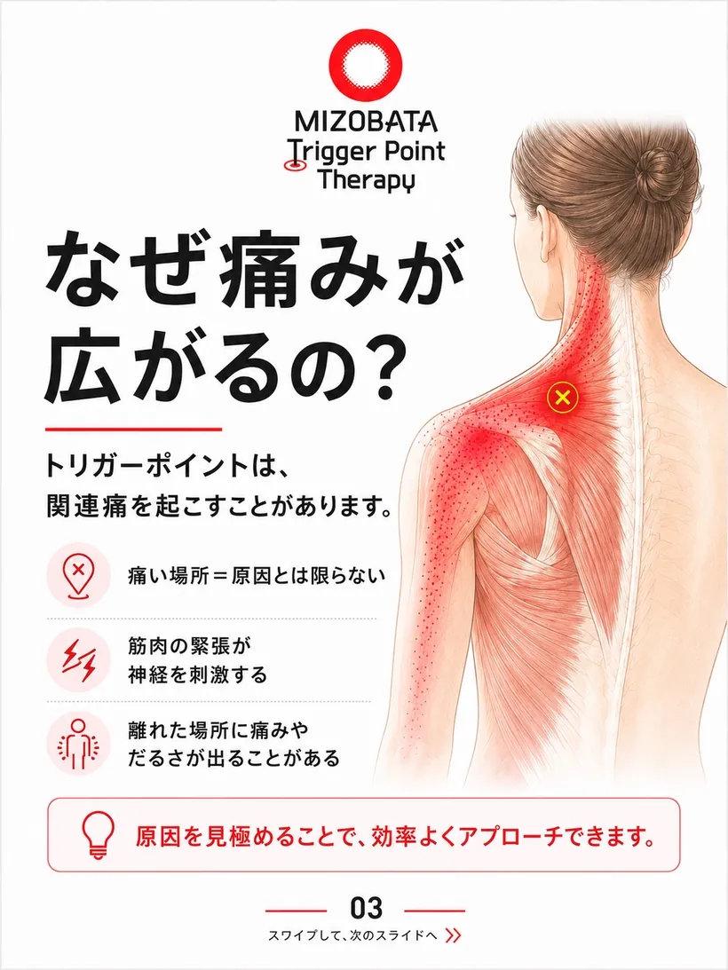 なぜ痛みが広がるの？ — 関連痛の仕組み