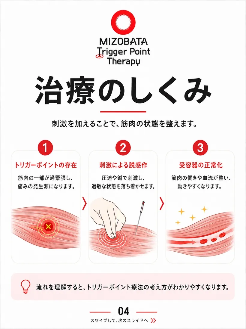 治療のしくみ — 刺激で筋肉の状態を整える